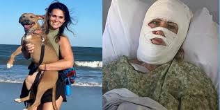 Savannah Acid Attack